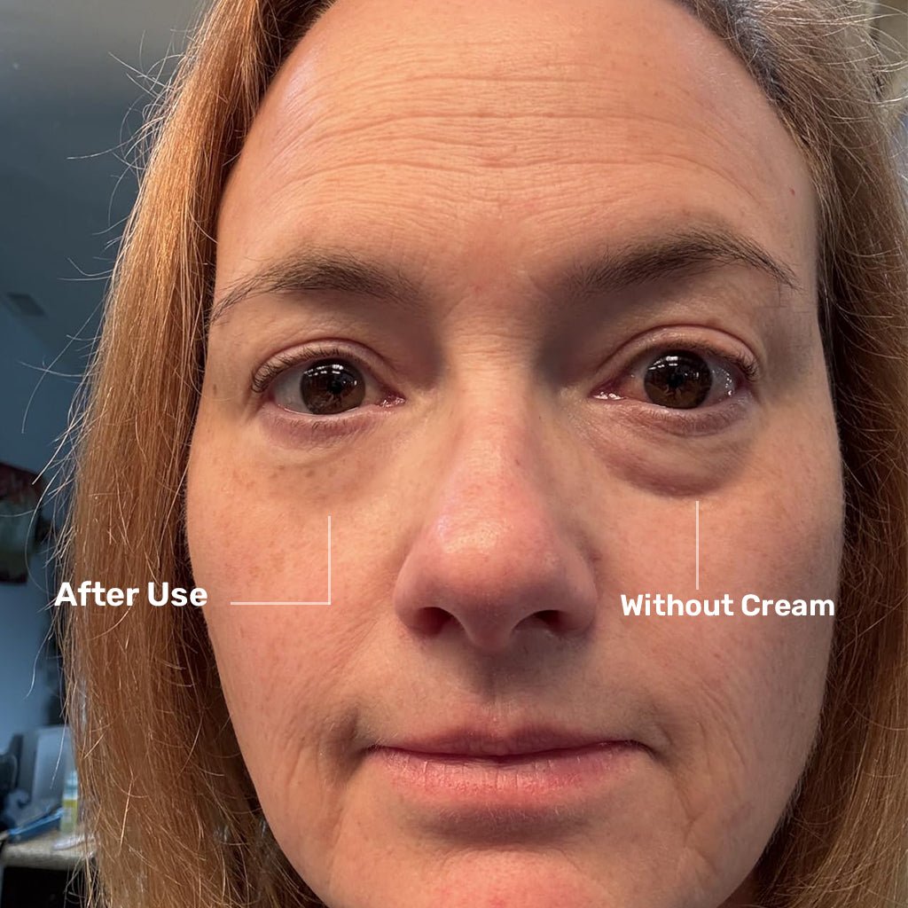 EYE CARE - Beauty Belliss